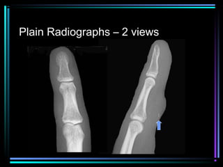 Plain Radiographs – 2 views

 