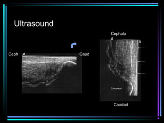 Ultrasound
Cephala
d
Ceph

Caud

Calcaneus

Caudad

 