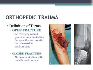 Overlying Definition ORTHOPEDIC SURGERY in medicine for students | PPT