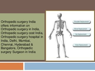 Orthopedic surgery India
offers information on
Orthopedic surgery in India,
Orthopedic surgery cost India,
Orthopedic surgery hospital in
India, Delhi, Mumbai,
Chennai, Hyderabad &
Bangalore, Orthopedic
surgery Surgeon in India
 