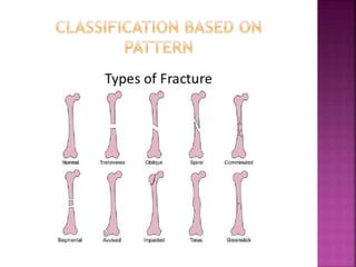Example Of Patterned Injuries Orthopedic trauma care | PPTX