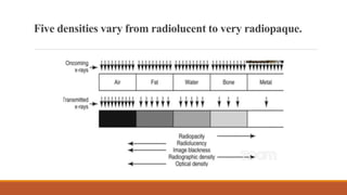 Are Rocks Radiopaque ORTHOPEDIC XRAYS.pptx