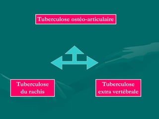 Tuberculose ostéo-articulaire
Tuberculose
du rachis
Tuberculose
extra vertébrale
 
