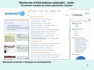 Recherche d’informations médicales : outils
                Un premier exemple de moteur généraliste, Exalead




Recherche avancée = bandeau en surimpression
                                                                    11
 