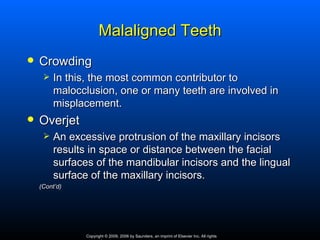 Malaligned Teeth
   Crowding
        In this, the most common contributor to
         malocclusion, one or many teeth are involved in
         misplacement.
   Overjet
        An excessive protrusion of the maxillary incisors
         results in space or distance between the facial
         surfaces of the mandibular incisors and the lingual
         surface of the maxillary incisors.
    (Cont’d)




                Copyright © 2009, 2006 by Saunders, an imprint of Elsevier Inc. All rights
 