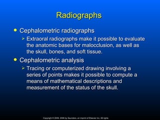 Radiographs
   Cephalometric radiographs
       Extraoral radiographs make it possible to evaluate
        the anatomic bases for malocclusion, as well as
        the skull, bones, and soft tissue.
   Cephalometric analysis
       Tracing or computerized drawing involving a
        series of points makes it possible to compute a
        means of mathematical descriptions and
        measurement of the status of the skull.




               Copyright © 2009, 2006 by Saunders, an imprint of Elsevier Inc. All rights
 