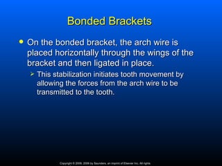 Bonded Brackets
   On the bonded bracket, the arch wire is
    placed horizontally through the wings of the
    bracket and then ligated in place.
       This stabilization initiates tooth movement by
        allowing the forces from the arch wire to be
        transmitted to the tooth.




               Copyright © 2009, 2006 by Saunders, an imprint of Elsevier Inc. All rights
 