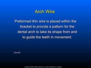 Arch Wire

Preformed thin wire is placed within the
   bracket to provide a pattern for the
 dental arch to take its shape from and
     to guide the teeth in movement.



(Cont’d)




           Copyright © 2009, 2006 by Saunders, an imprint of Elsevier Inc. All rights
 