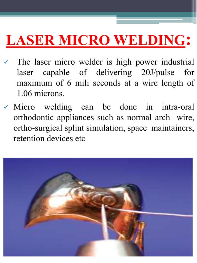 orthodontics soldering and welding