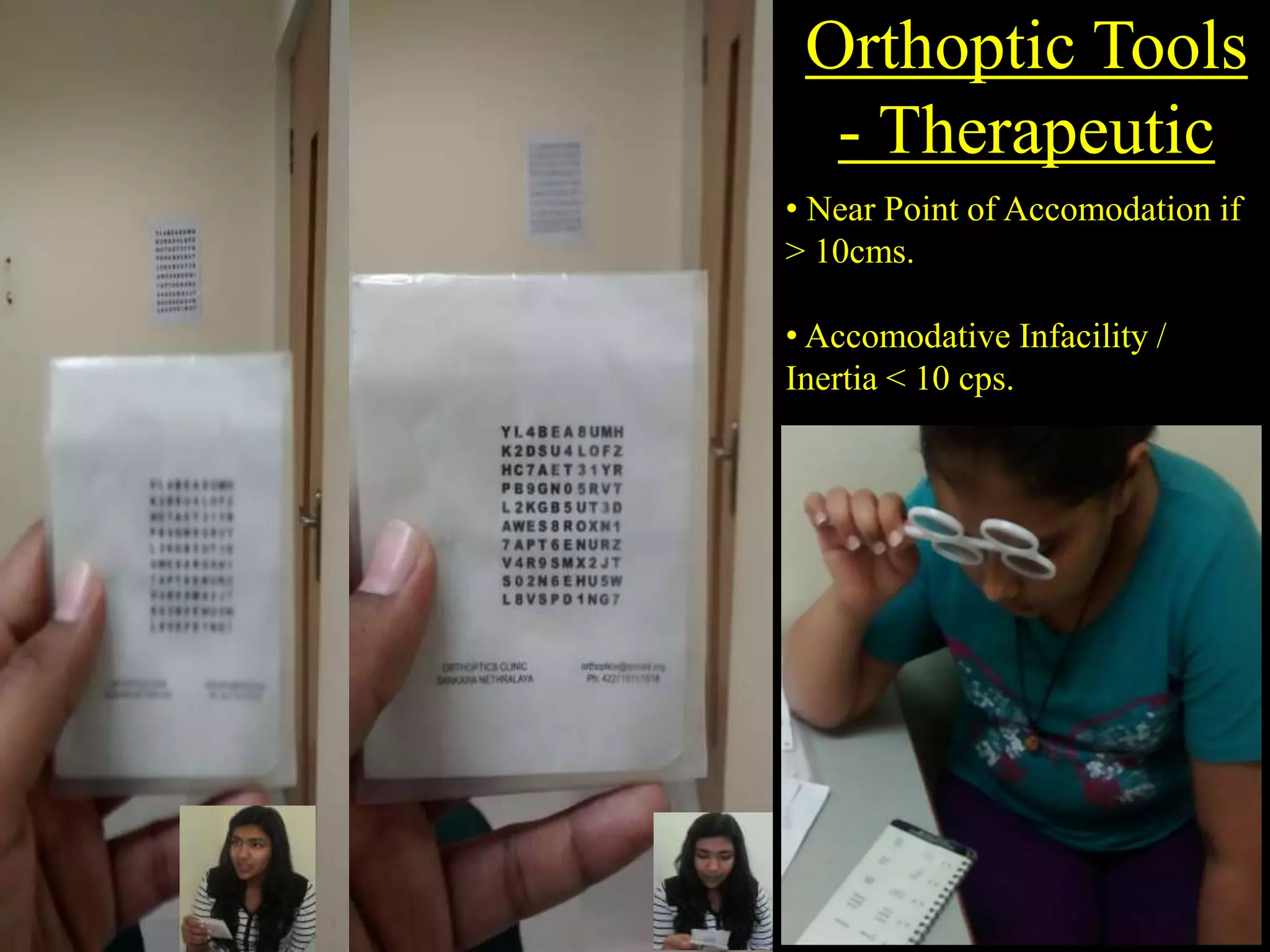 Orthoptic Tools
- Therapeutic
• a
• Near Point of Accomodation if
> 10cms.
• Accomodative Infacility /
Inertia < 10 cps.
Brock string
Flippers
Jump Convergence
 