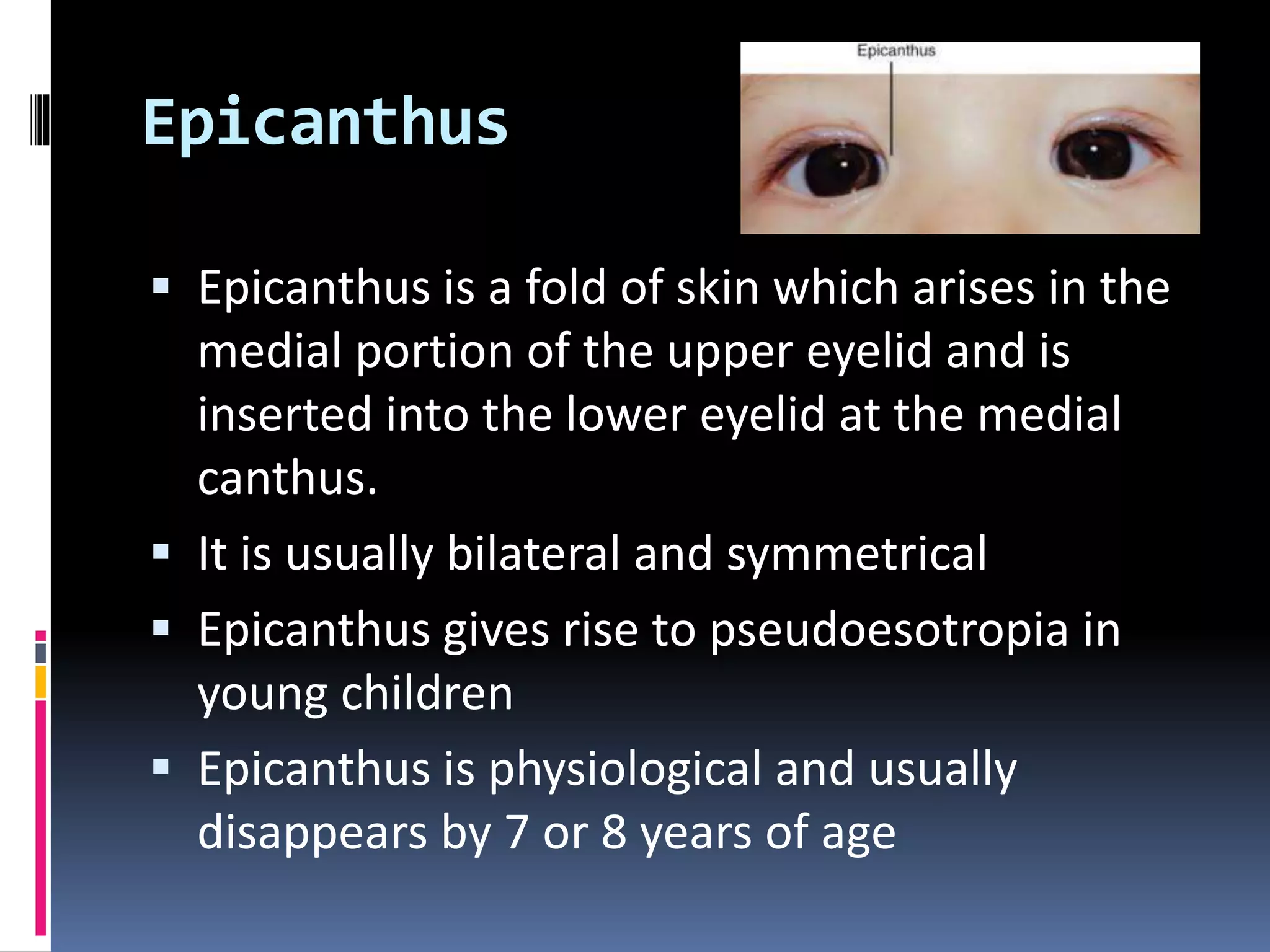 Epicanthus
 Epicanthus is a fold of skin which arises in the
medial portion of the upper eyelid and is
inserted into the lower eyelid at the medial
canthus.
 It is usually bilateral and symmetrical
 Epicanthus gives rise to pseudoesotropia in
young children
 Epicanthus is physiological and usually
disappears by 7 or 8 years of age
 