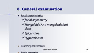 3. General examination
 Facial characteristics
facial asymmetry
Mongoloid / Anti mongoloid slant
slant
Epicanthus
Hypertelorism
Searching movements
Optom. Ankit Varshney 19
 