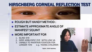 HIRSCHBERG CORNEAL REFLECTION TEST
 ROUGH BUT HANDY METHOD :
 ESTIMATE APPROXIMATE ANGLE OF
MANIFEST SQUINT
 MORE IMPORTANT FOR
Optom. Ankit Varshney 23
1. BLIND EYE
2. DEEP AMBLYOPIC EYE WITH LOW VA
3. UNABLE TO MAINTAIN FIXATION FOR
LONGER TIME e.g. YOUNG CHILDREN
 