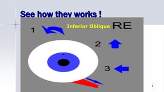 See how they works !
SURERIOR RECTUS
Optom. Ankit Varshney 3
Superior ObliqueInferior Oblique
 