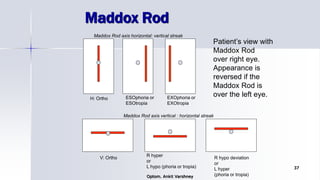 Maddox Rod
Optom. Ankit Varshney
37
H: Ortho ESOphoria or
ESOtropia
EXOphoria or
EXOtropia
V: Ortho
R hyper
or
L hypo (phoria or tropia)
R hypo deviation
or
L hyper
(phoria or tropia)
Patient’s view with
Maddox Rod
over right eye.
Appearance is
reversed if the
Maddox Rod is
over the left eye.
Maddox Rod axis horizontal: vertical streak
Maddox Rod axis vertical : horizontal streak
 