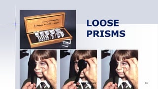 LOOSE
PRISMS
Optom. Ankit Varshney 41
 