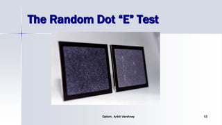 The Random Dot “E” Test
Optom. Ankit Varshney 53
 