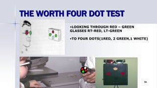 THE WORTH FOUR DOT TEST
Optom. Ankit Varshney 59
•LOOKING THROUGH RED – GREEN
GLASSES RT-RED, LT-GREEN
•TO FOUR DOTS(1RED, 2 GREEN,1 WHITE)
 