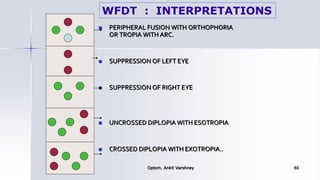  PERIPHERAL FUSION WITH ORTHOPHORIA
OR TROPIA WITH ARC.
 SUPPRESSION OF LEFT EYE
 SUPPRESSION OF RIGHT EYE
 UNCROSSED DIPLOPIA WITH ESOTROPIA
 CROSSED DIPLOPIA WITH EXOTROPIA..
Optom. Ankit Varshney 60
WFDT : INTERPRETATIONS
 