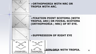 ORTHOPHORIA WITH NRC OR
TROPIA WITH ARC.
FIXATION POINT SCOTOMA (WITH
TROPIA; ARC) OR FOVEAL SCOTOMA
(ORTHOPHORIA ; NRC) OF RT EYE.
SUPPRESSION OF RIGHT EYE
 DIPLOPIA WITH TROPIA.Optom. Ankit Varshney 62
 