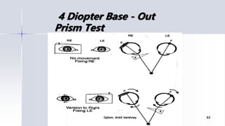 4 Diopter Base - Out
Prism Test
Optom. Ankit Varshney 63
 