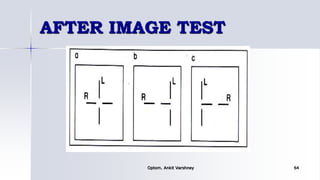 AFTER IMAGE TEST
Optom. Ankit Varshney 64
 