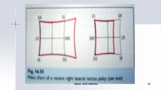 Optom. Ankit Varshney 67
 