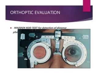 Three Rods Test Orthoptics Introduction test | PPTX