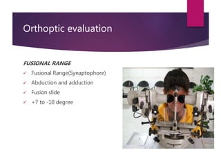 Orthoptic evaluation
FUSIONAL RANGE
 Fusional Range(Synaptophore)
 Abduction and adduction
 Fusion slide
 +7 to -10 de...