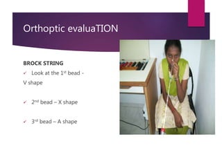 Orthoptic evaluaTION
BROCK STRING
 Look at the 1st bead -
V shape
 2nd bead – X shape
 3rd bead – A shape
 
