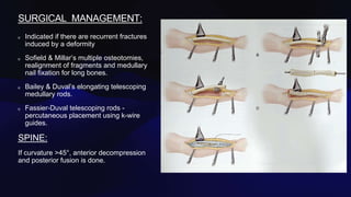 SURGICAL MANAGEMENT:
Indicated if there are recurrent fractures
induced by a deformity
Sofield & Millar’s multiple osteotomies,
realignment of fragments and medullary
nail fixation for long bones.
Bailey & Duval’s elongating telescoping
medullary rods.
Fassier-Duval telescoping rods -
percutaneous placement using k-wire
guides.
SPINE:
If curvature >45°, anterior decompression
and posterior fusion is done.
Caption
 
