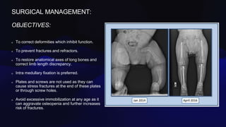 SURGICAL MANAGEMENT:
OBJECTIVES:
To correct deformities which inhibit function.
To prevent fractures and refractors.
To restore anatomical axes of long bones and
correct limb length discrepancy.
Intra medullary fixation is preferred.
Plates and screws are not used as they can
cause stress fractures at the end of these plates
or through screw holes.
Avoid excessive immobilization at any age as it
can aggravate osteopenia and further increases
risk of fractures.
 