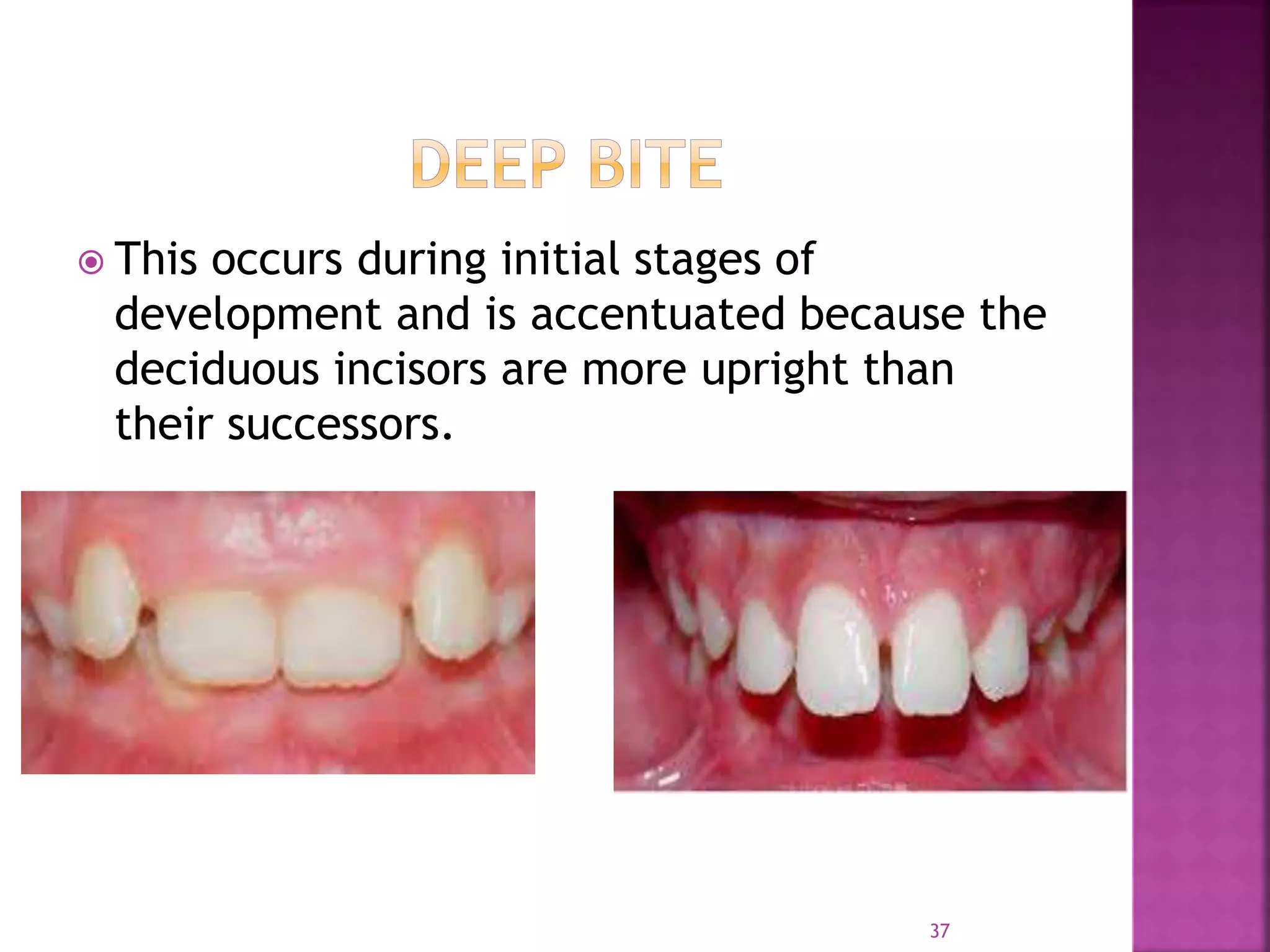 Development of the dentition | PPTX