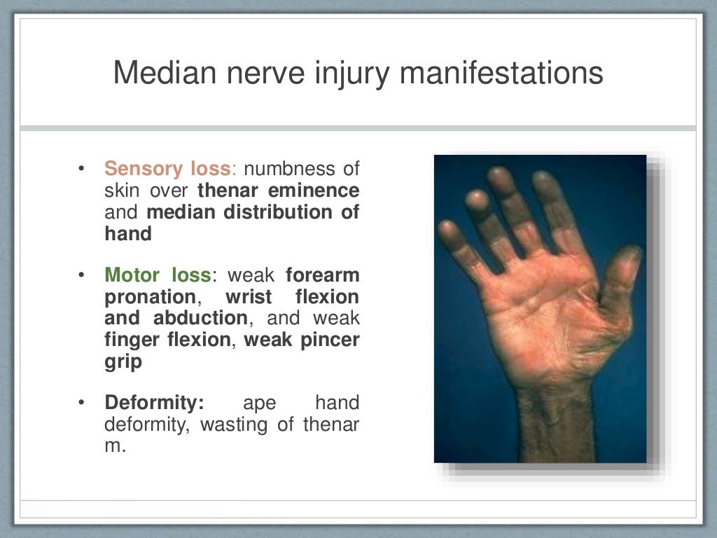 Peripheral nerve injuries