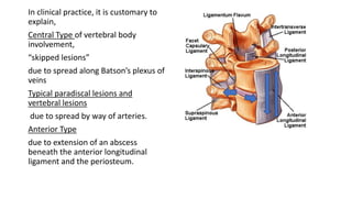 In clinical practice, it is customary to
explain,
Central Type of vertebral body
involvement,
“skipped lesions”
due to spread along Batson’s plexus of
veins
Typical paradiscal lesions and
vertebral lesions
due to spread by way of arteries.
Anterior Type
due to extension of an abscess
beneath the anterior longitudinal
ligament and the periosteum.
 