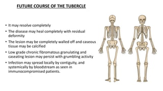 FUTURE COURSE OF THE TUBERCLE
• It may resolve completely
• The disease may heal completely with residual
deformity
• The lesion may be completely walled off and caseous
tissue may be calcified
• Low grade chronic fibromatous granulating and
caseating lesion may persist with grumbling activity
• Infection may spread locally by contiguity, and
systemically by bloodstream as seen in
immunocompromised patients.
 
