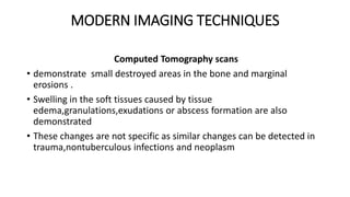 MODERN IMAGING TECHNIQUES
Computed Tomography scans
• demonstrate small destroyed areas in the bone and marginal
erosions .
• Swelling in the soft tissues caused by tissue
edema,granulations,exudations or abscess formation are also
demonstrated
• These changes are not specific as similar changes can be detected in
trauma,nontuberculous infections and neoplasm
 