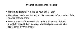 Magnetic Reasonance Imaging
• confirm findings seen in plain x-rays and CT scan
• They show predestructive lesions like edema or inflammation of the
bone in active disease
• Encroachment of the vertebral canal,displacement of dural
sheath,localized tuberculoma,generalized granuloma can be
appreciated by MRI images
 