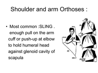 Shoulder and arm Orthoses :
• Most common :SLING .
enough pull on the arm
cuff or push-up at elbow
to hold humeral head
against glenoid cavity of
scapula
 