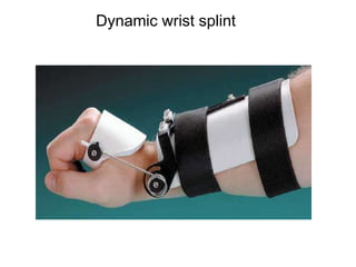 Dynamic wrist splint
 