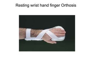 Resting wrist hand finger Orthosis
 