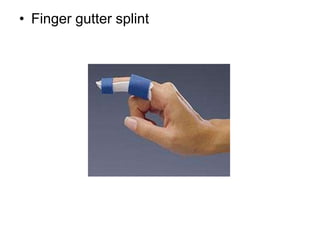 • Finger gutter splint
 