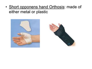 • Short opponens hand Orthosis: made of
either metal or plastic
 