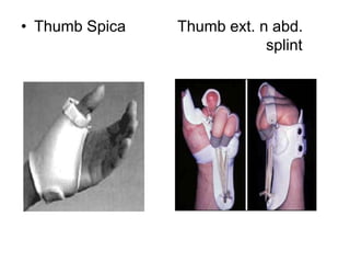 • Thumb Spica Thumb ext. n abd.
splint
 