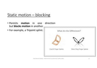 Static motion – blocking
• Permits motion in one direction
but blocks motion in another.
• For example, a Tripoint splint.
OM PRASAD BISWAL I PROSTHETIST & ORTHOTIST (MPO, BPO) 13
 