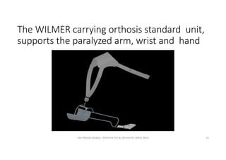 The WILMER carrying orthosis standard unit,
supports the paralyzed arm, wrist and hand
OM PRASAD BISWAL I PROSTHETIST & ORTHOTIST (MPO, BPO) 33
 