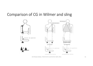Comparison of CG in Wilmer and sling
OM PRASAD BISWAL I PROSTHETIST & ORTHOTIST (MPO, BPO) 40
 