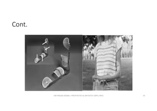 Cont.
OM PRASAD BISWAL I PROSTHETIST & ORTHOTIST (MPO, BPO) 43
 
