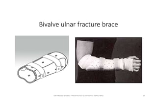 Bivalve ulnar fracture brace
OM PRASAD BISWAL I PROSTHETIST & ORTHOTIST (MPO, BPO) 65
 