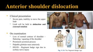 orthopaedics shoulder dislocationss.pptx